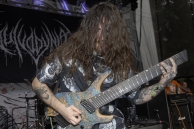 VULVODYNIA